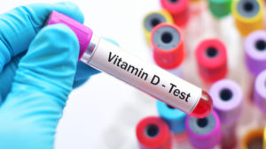 vitamin D test image