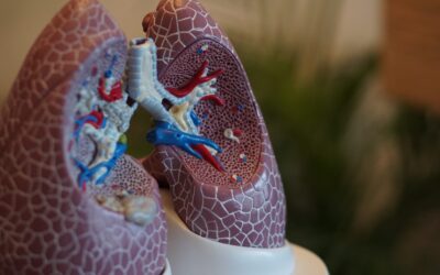 New Study Explains Why Lung Cancer Does Not Respond Favorably to Immunotherapy