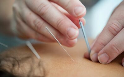 Needles of Healing: Unlocking the Timeless Power of Acupuncture for Cancer Patients