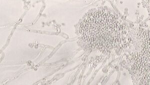 Candida and Cancer: The Proof is in the Blood