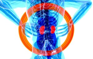 Surviving Kidney Cancer