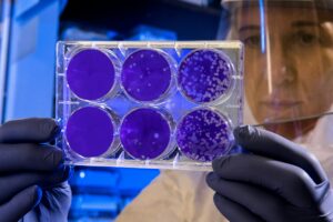 Colon Cancer Linked to Mouth Bacteria