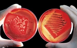 Researchers Have Discovered Certain Mouth Bacteria Can Melt Away Cancer Cells