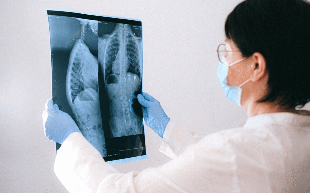 New MRI Agent Could Detect Lung Cancer Earlier