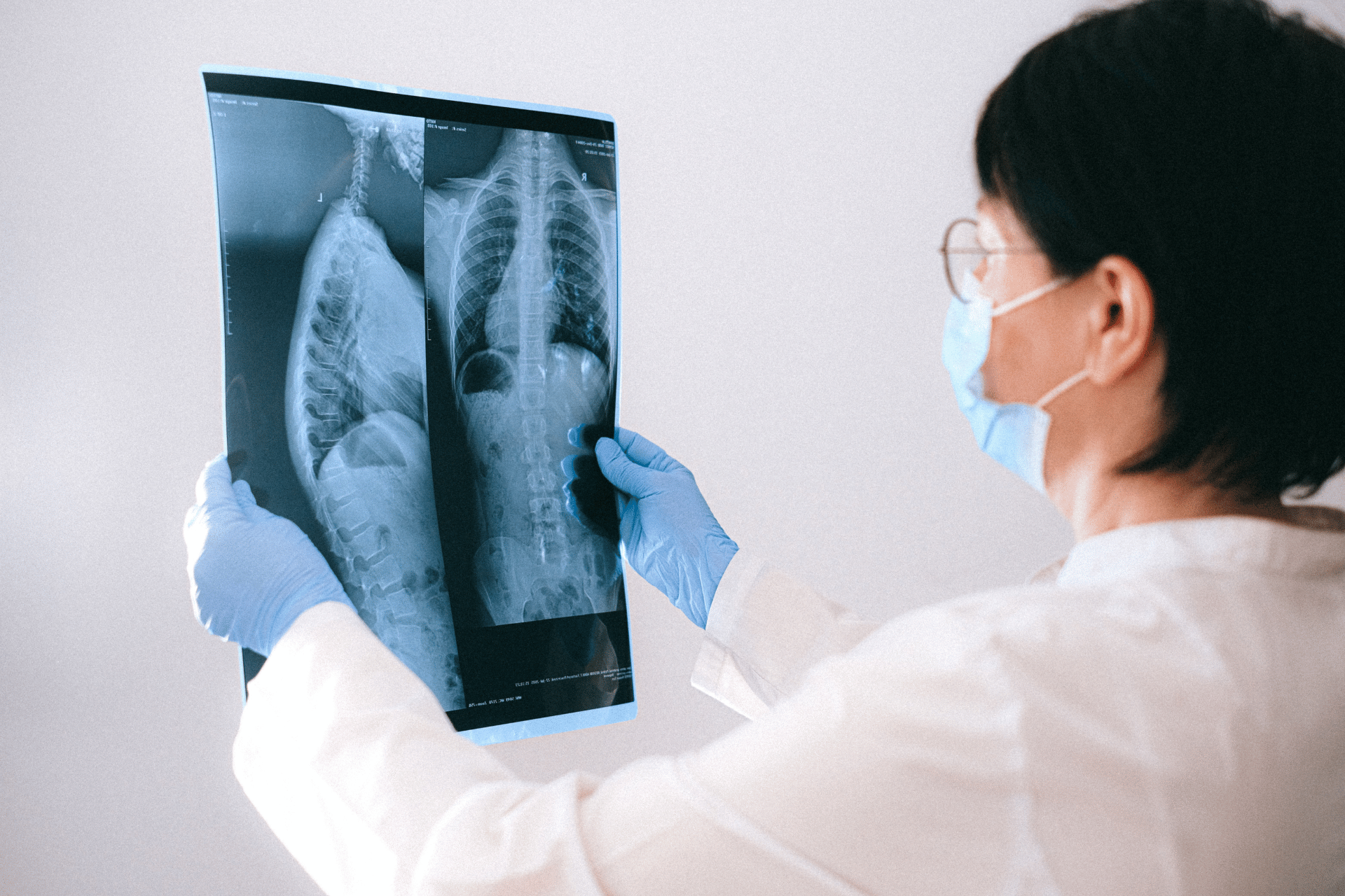 New MRI Agent Could Detect Lung Cancer Earlier
